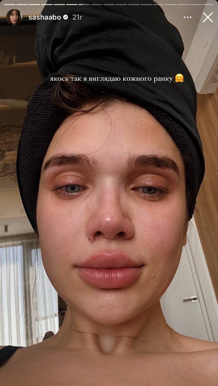 Заплакана Саша Бо повідомила про проблеми зі здоров’ям